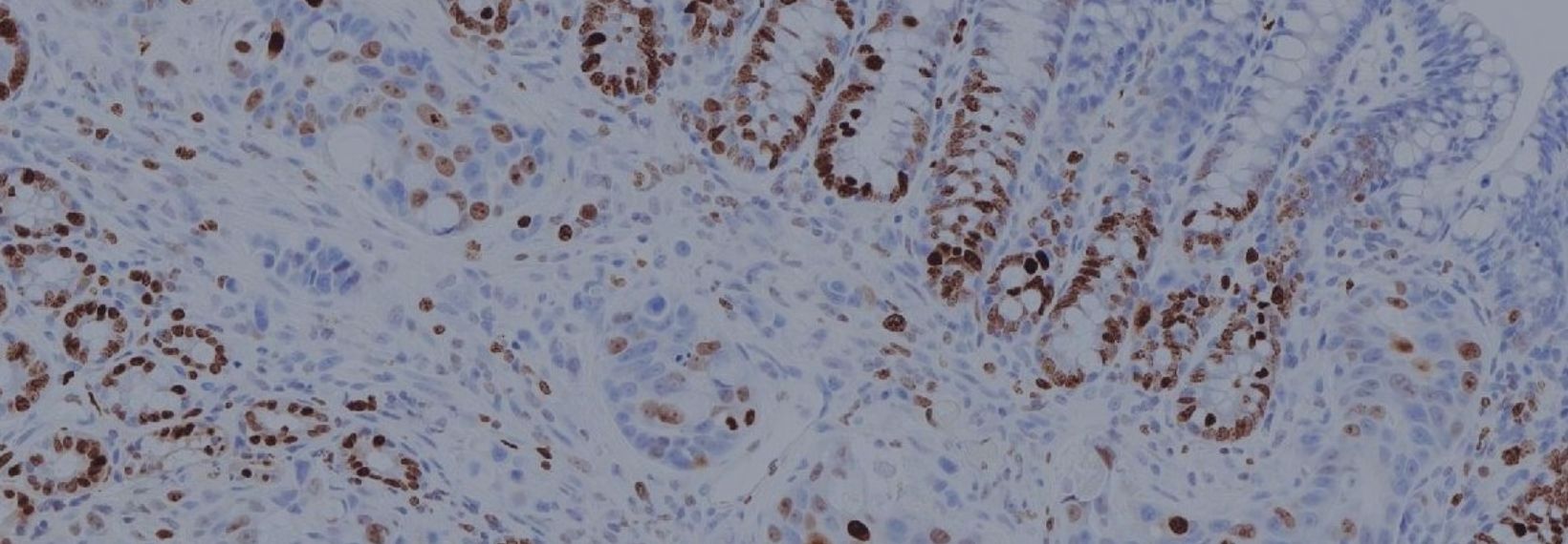 IHC slide image