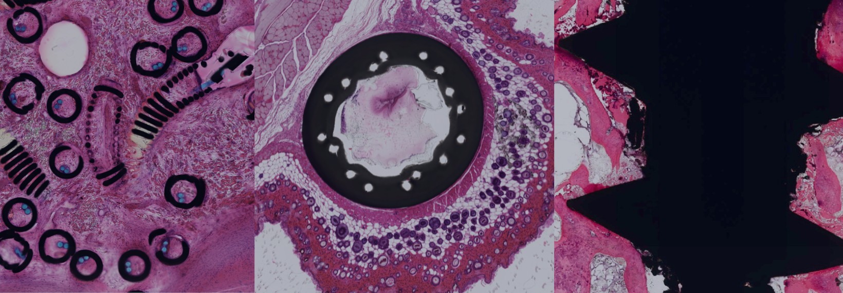 Stained medical devices sections