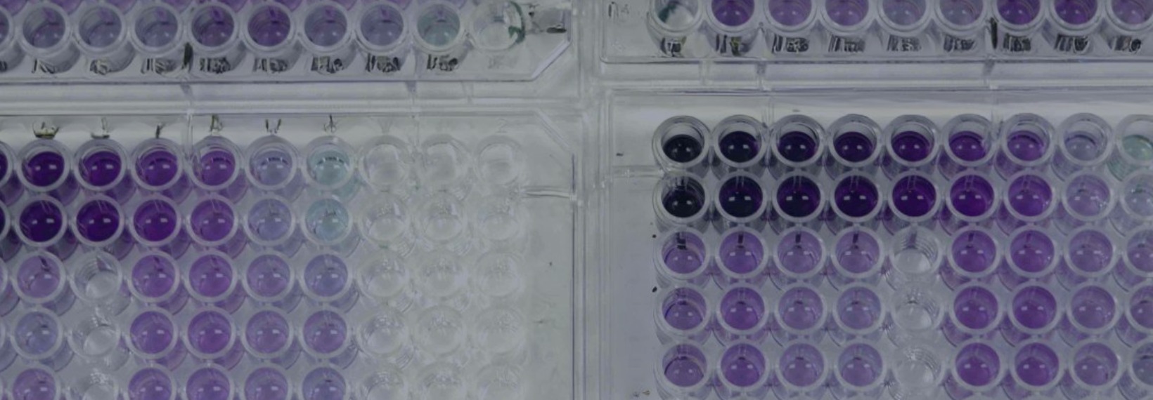 Western Immunoblot in action